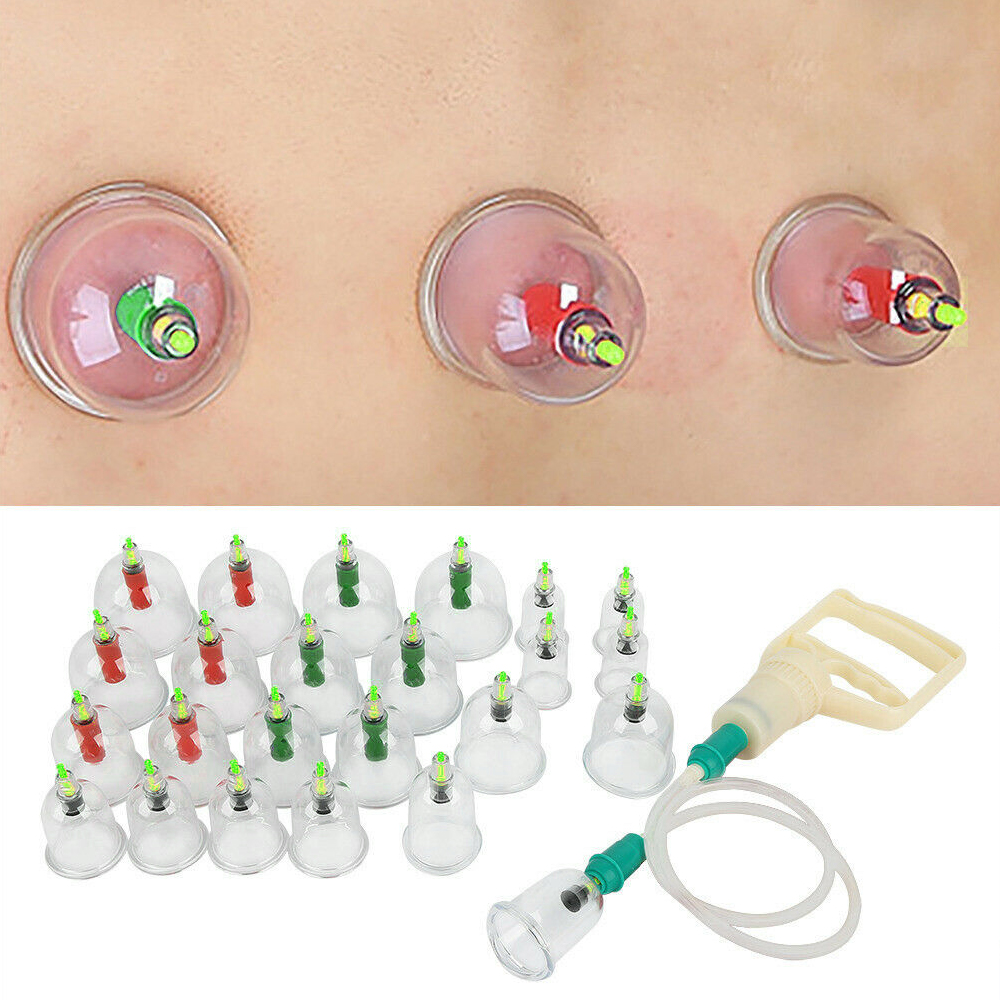 Free Shipping Pain Relief 24 Cups Vacuum Cupping Set Massage Kit