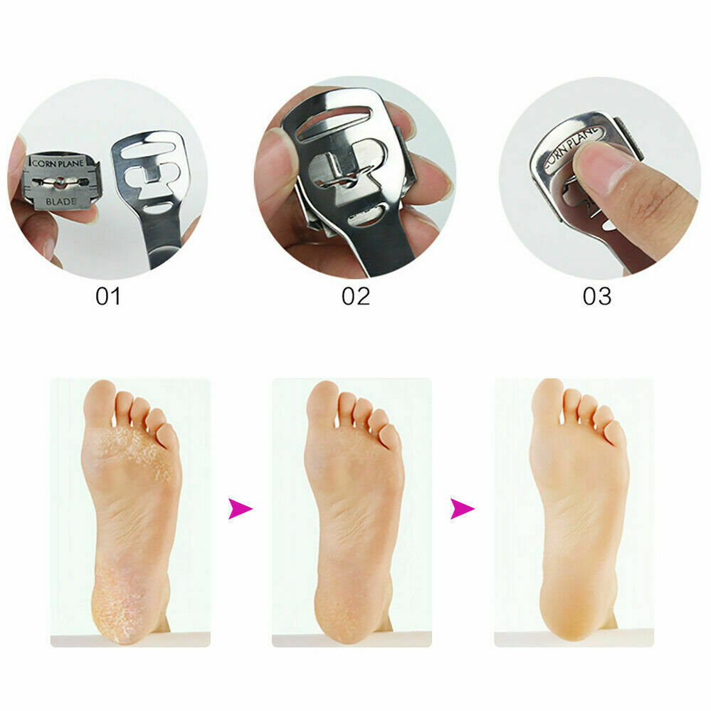 6 PC Callus Remover Feet Hard Skin Remover Corn Shaver Pedicure Replace Blades